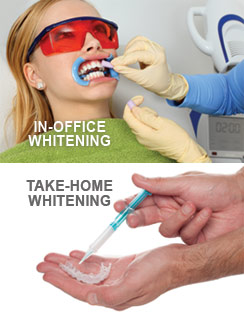 Teeth-whitening-indianapolis